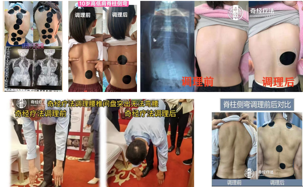 奇经介绍.png